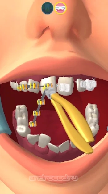 Perfect Smile 3D - скриншот 2