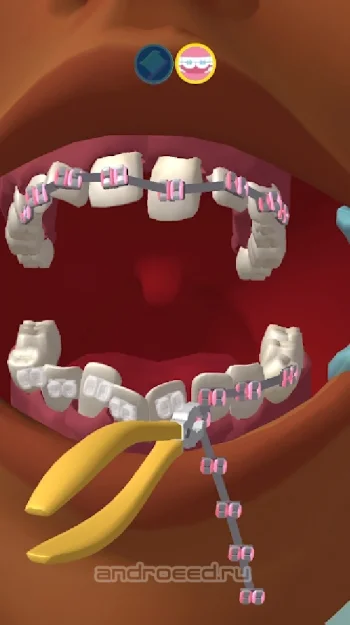 Perfect Smile 3D - скриншот 5